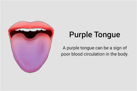 tongue     health