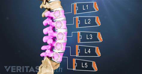 pain   lumbar spine