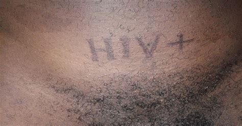 mashariaz “hiv positive people to be marked near their genitals” jacob