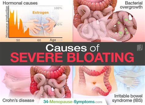 Severe Bloating Important Things To Know Menopause Now