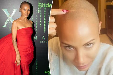 Jada Pinkett Smith Shares Update On Hair Loss Due To Alopecia