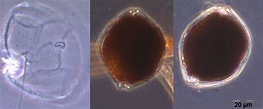Afbeeldingsresultaten voor "alexandrium Pseudogonyaulax". Grootte: 263 x 109. Bron: www.io-warnemuende.de
