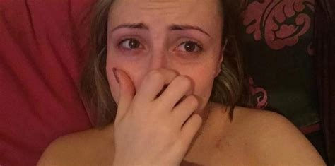 woman shares before and after panic attack photos ny