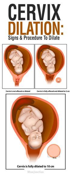 c section vbac birth info