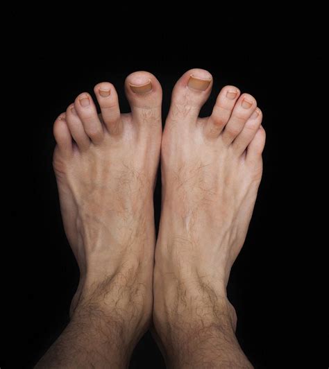 Every Man S Secret Shame Those Gnarly Feet Health Daily