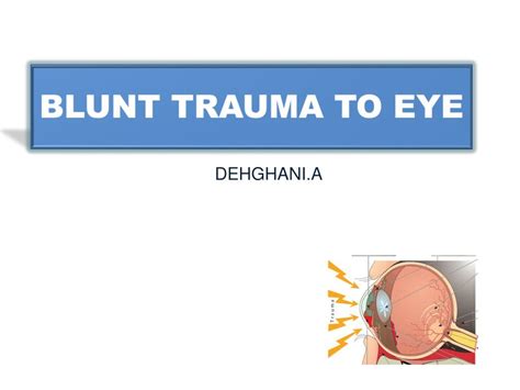 blunt trauma  eye powerpoint    id