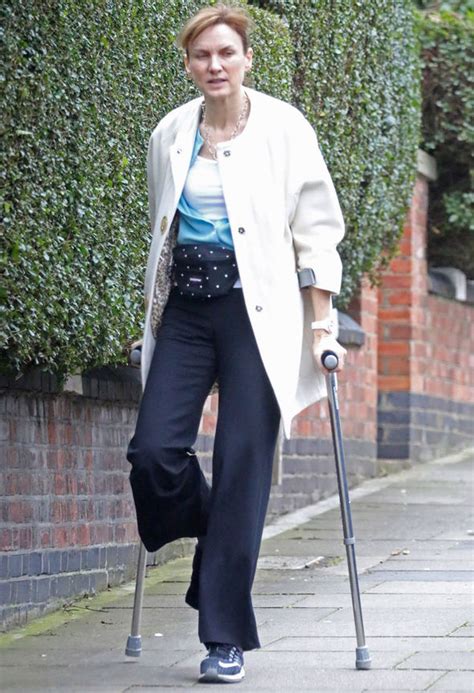 Fiona Bruce Hobbles Around With The Help Of Crutches After