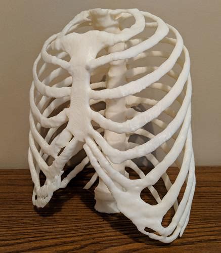 Ai May Help Overcome Barriers To Medical 3d Printing