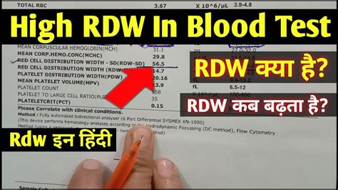 rdw blood test hindi high rdw  blood test rdw test means rdw test report youtube