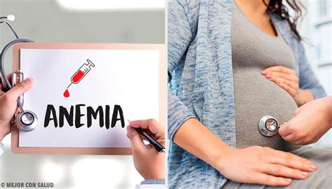 the best and simplest remedies to treat anemia during