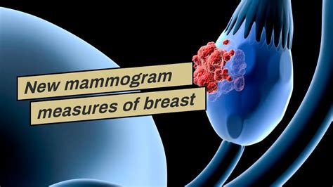 new mammogram measures of breast cancer risk could revolutionize