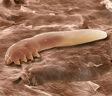 eyelash mite sem photograph demodex mites scanning electron