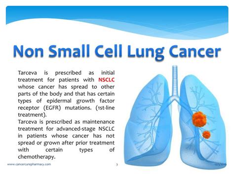 ppt non small cell lung cancer pancreatic cancer treatment medicine