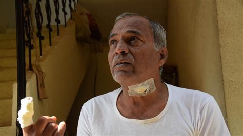 ‘slice’ Of The Action 60 Year Old Pune Man Injured After Kite Manja