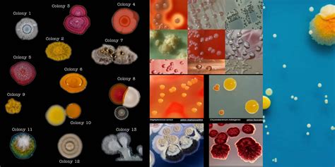 colony morphology  bacteria  examples