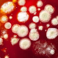 fungal infections thebody