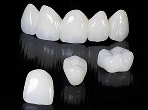 entire benefit  ceramic crowns  fillings dr sunil dental blog