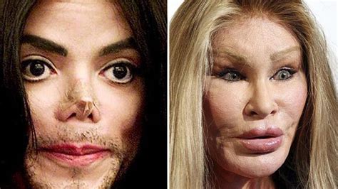 celebrities    plastic surgery disasters