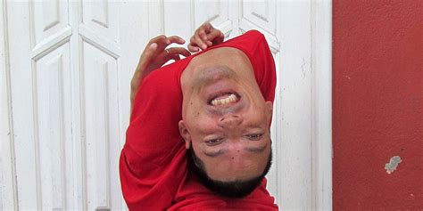 man born   upside  head rpics