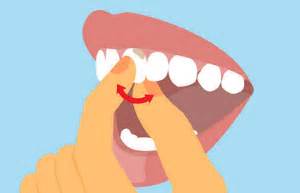 dintii care se misca pot fi salvati  dent