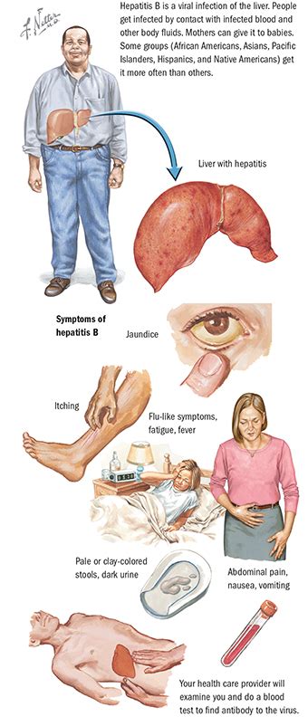 Hepatitis C Andreas Digestive Clinic Singapore