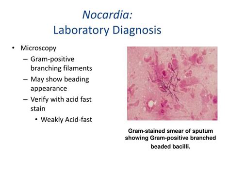 Ppt Gram Positive Bacilli Part Four Powerpoint