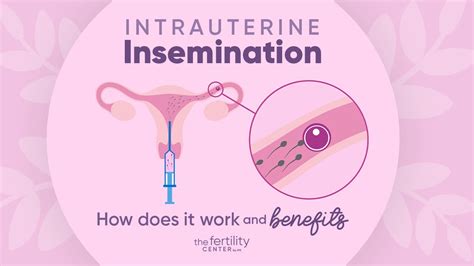 intrauterine insemination how does it work and benefits the fertility