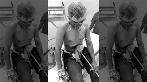 Photos Santosh Nayak Indian Construction Worker Impaled Inches From Death