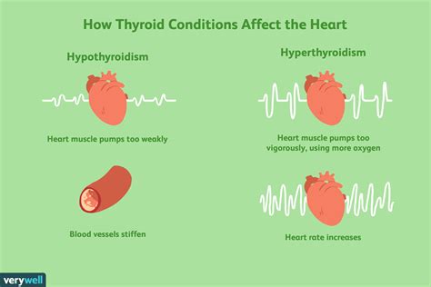 thyroid disease affect  heart