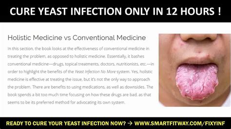 Oral Yeast Infection Symptoms Astonishing Truths