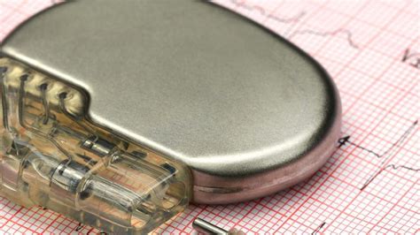 drug controller issues advisory  pacemaker malfunction india news hindustan times