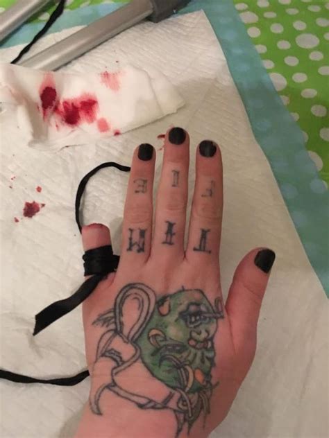Woman Claims To Have Cut Off Her Little Finger Then Bragged About It On