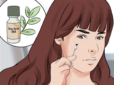 how to remove moles without surgery skin tag removal
