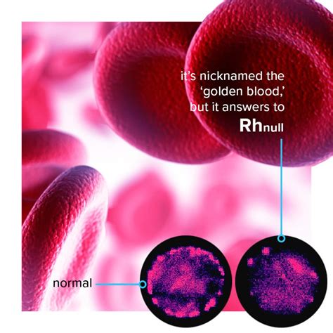 rhnull blood  rarest type