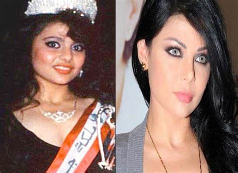 Haifa Wehbe Plastic Surgery Before And After Plastic Surgery