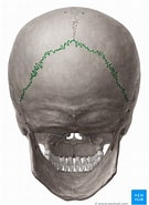 Bildergebnis für Multiple Schaltknochen in Den Schädelnähten Wormian bones. Größe: 135 x 185. Quelle: www.kenhub.com