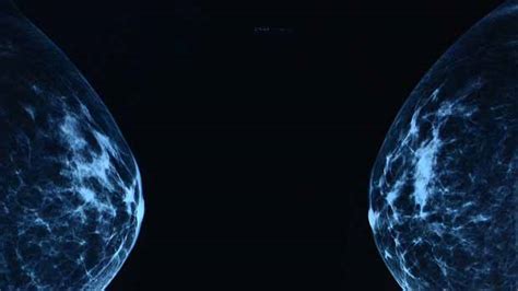 making breast screening  accurate cancer research uk