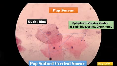 pap stain introduction principle staining procedure result interpretation