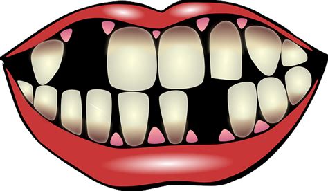 clipart gap  teeth   cliparts  images