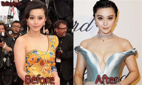 Fan Bingbing Plastic Surgery Before And After Boob Job Pictures