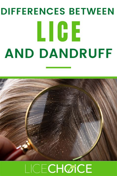 lice  dandruff    differences  lice lice eggs