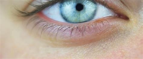 The 10 Most Common Eye Problems And How To Treat Them