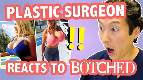 the largest breast implants ever plastic surgeon reacts to botched