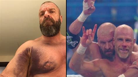 Triple H Shares A Grim Picture After Ripping His Pectoral Muscle Ladbible