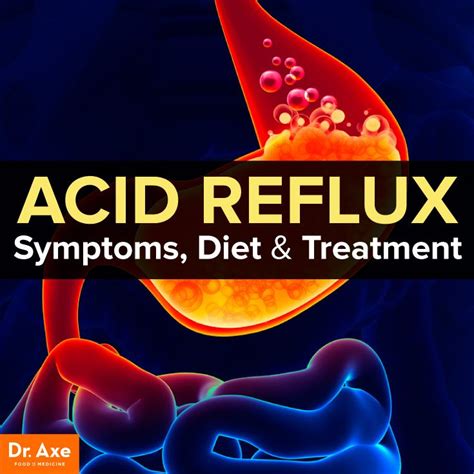 reflux symptoms ideas  pinterest acid reflux natural