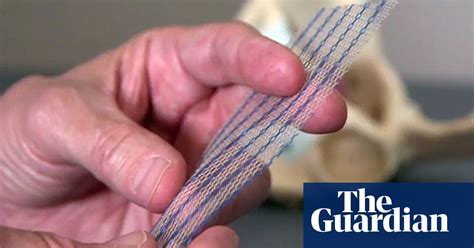 Doctors Not Told About Full Risk Of Vaginal Mesh Implants Society