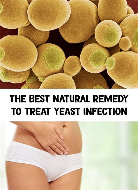 natural remedy  treat yeast infection yeast infection