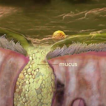 mucus       disease  blog  mangotarian