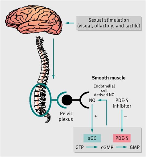 Erectile Dysfunction The Bmj