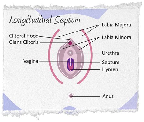 vertical or complete vaginal septum
